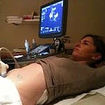Pregnant woman having ultra sound